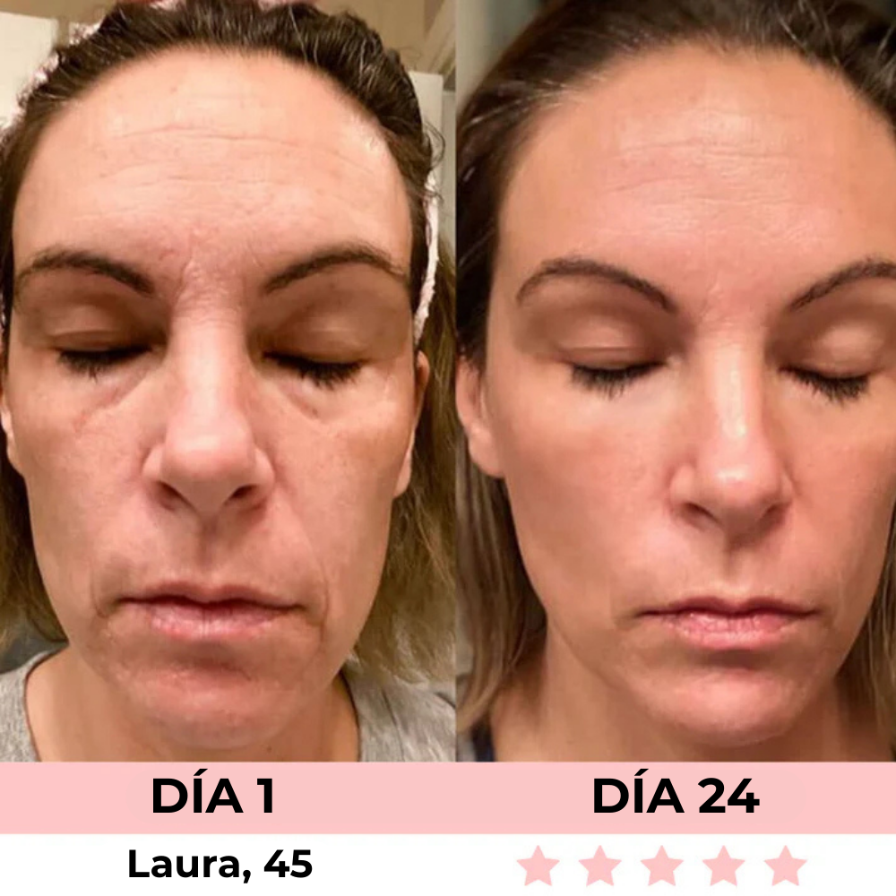 Escultor Facial LED 7-En-1 Veltura™ + Sérum Facial (GRATIS) - Edición Limitada