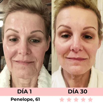 Escultor Facial LED 7-En-1 Veltura™ + Sérum Facial (GRATIS) - Edición Limitada